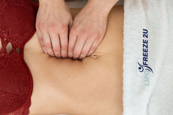diastasis recti treatment Dover