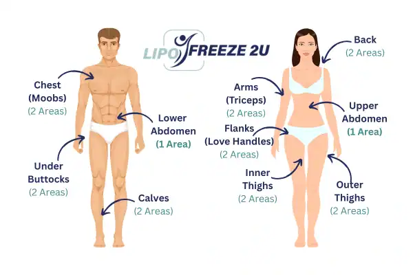 Areas you can have fat freezing treatment Dover