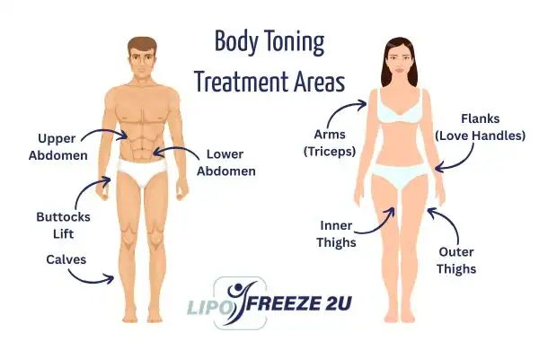 Graphic showing where you can have Body toning Treatment Dover on your body