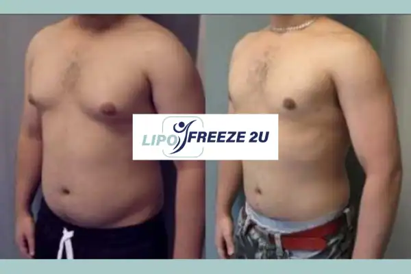 How Long Does It Take to See Results Dover?