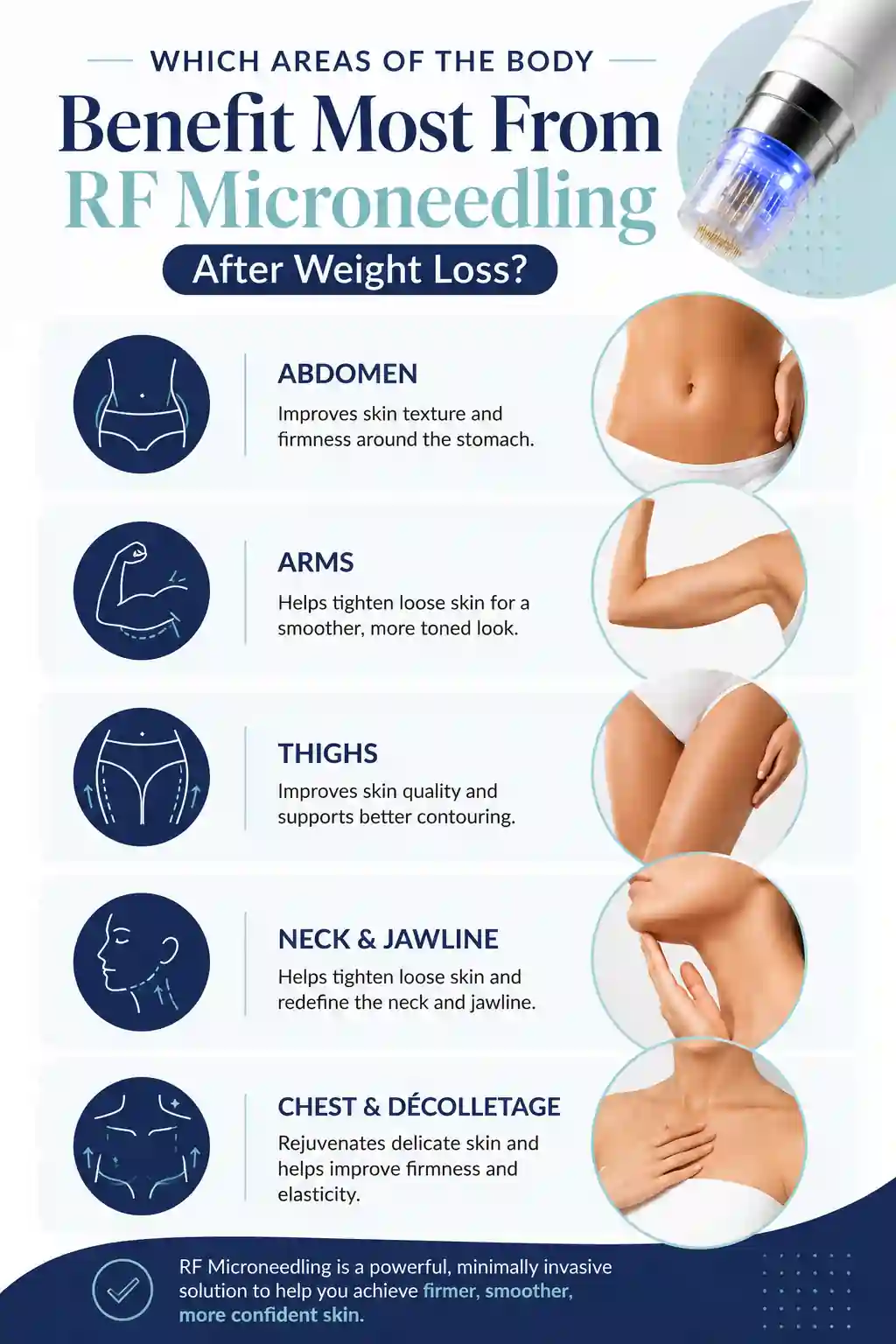 Which Areas of the Body Benefit Most From RF Microneedling After Weight Loss Dover